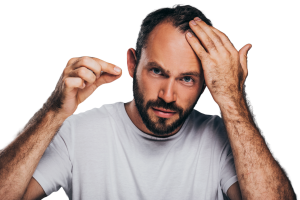 Early signs of male pattern baldness​