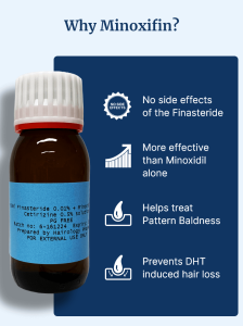 Minoxidil-based advanced formula to treat male hair loss