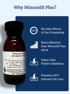 Hair loss treatment for men and women using Minoxidil Plus